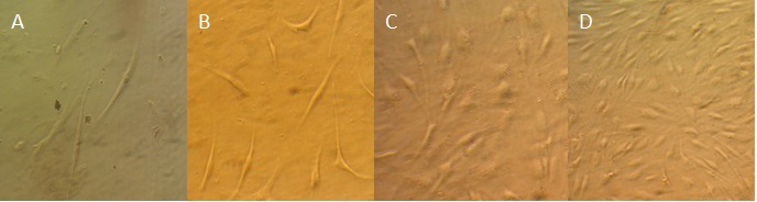 Figure 1: Human ADSCs expanded to a spindle-shaped fibroblast-like morphology. Phase contrast images (40x magnification) at A) Passage 0, B) Passage 1, C) Passage 2, and D) Passage 3.