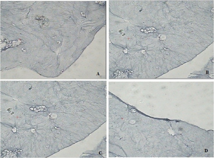 Figure 5: Immunohistochemical assessment of chondrogenic differentiation of adipose-derived stem cells on the different scaffolds at 2 weeks (A–D). This image refers to PRP (A), PCL (B) and Fibrin glue (C) scaffolds and also mention the protein being analyzed. Also include undifferentiated ADSCs as control (D).