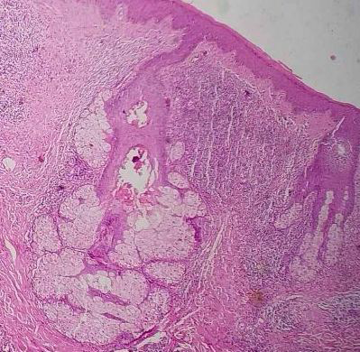 Figure 3: Histopathological Examination 10X Magnification.