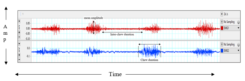 Figure 1: Waveform of sEMG Signal in Time Vs. Amplitude Domain.