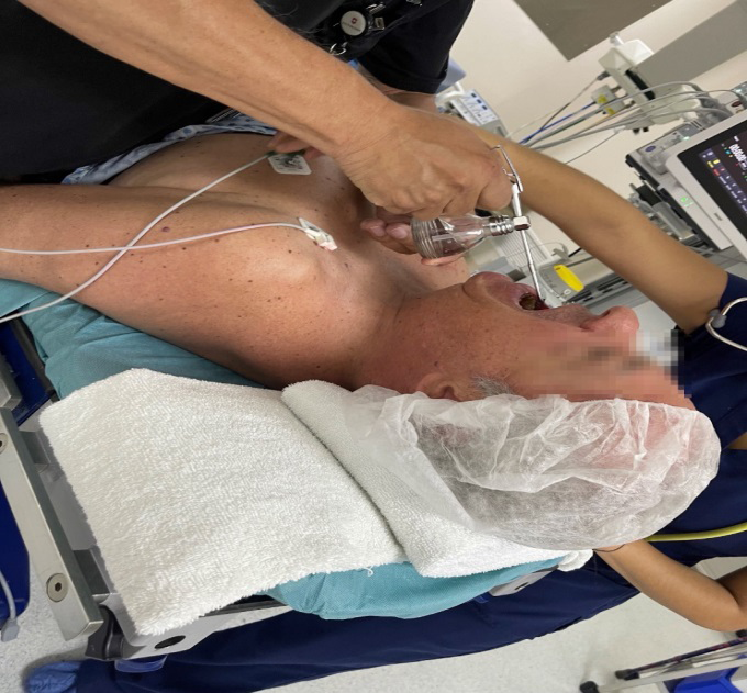 Figure 2: Patient under airway topicalization.