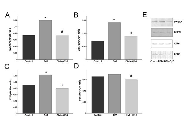 Figure 1: (A-E) The brain protein levels of TWEAK, GRP78, ATF6 and PERK detected by western blotting. The data is expressed as mean ± SD; n=8. * p<0.001 versus control group; # p<0.01 versus DM group.