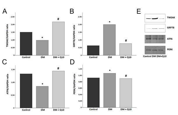 Figure 2: (A-E) The liver protein levels of TWEAK, GRP78, ATF6 and PERK detected by western blotting. The data is expressed as mean ± SD; *, p<0.05 versus control group; #, p<0.01 versus DM group.