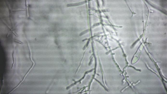 Figure 4: Microscopic feature of _M. audouinii_ with characterestic pectinate bodies septate hyphae while on culture media dermatophyte isolate was obtained which identified according to its macro- morphological and micro-morphological characters as _M._ _audouinii_. Colonies of _M. audouinii_ isolate showed white surface color on mycobiotic with radiating edges turns red on DTM. the isolate turned the medium to red. Microscopic examination of the colonies showed the characteristic of _M._ _audouinii_ as pectinate hyphae, microconidia and rudimentary macroconidia.