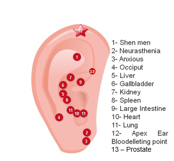 Figure 8: Auricular acupuncture points are used in the treatment of patients with prostatic hyperplasia.