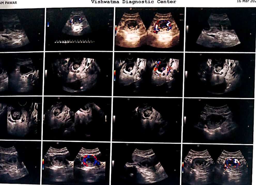 Figure 1: Gross examination revealed specimen of uterus.