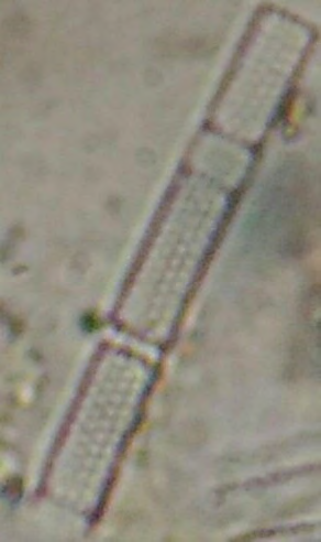 Figure 1: Aulacoseira observed under Light microscope (Olympus CX41).