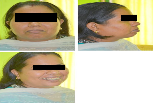 Figure 1: Pre-treatment photograph profile.