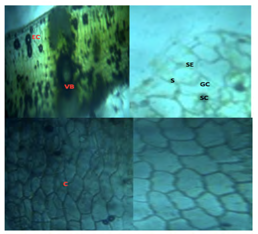 Figure 3: A: X100 Tranverse Section Through Lamina. B: X100 Cross Section Through the Lamina100 Fragments Showing Stellate Multicellular Trichomes, C: X100 Fragments Showing Stellate Multicellular Trichomes (UE; Lower Epidermis, P; Palisade layer, SM; Spongy Mesophyll, T; Trichome, LE; Lower Epidermis)
