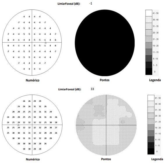 Figure 1: Visual field of both eyes.
