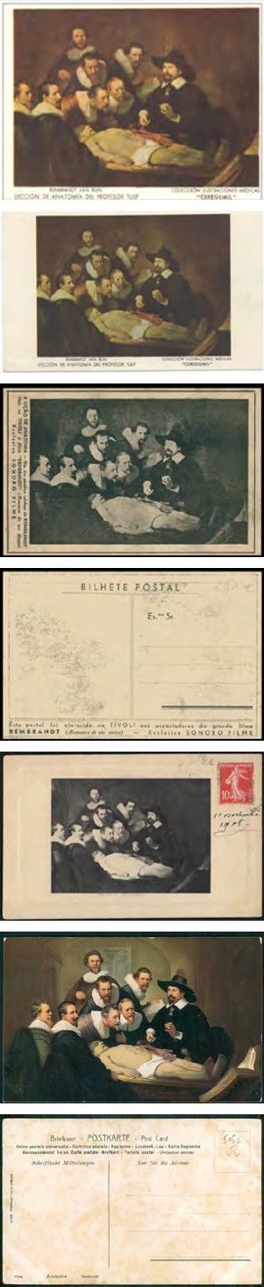 Figure 3: Philocardic and philatelic materials on human anatomy.