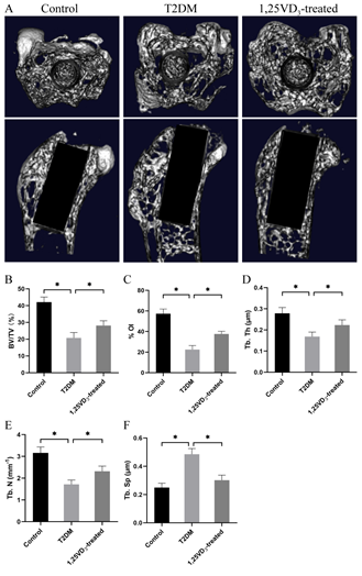 Figure 2: 1,25VD3 improved bone quality of T2DM rats. Micro-CT images of femur with implants (A) and quantitative results of micro-CT evaluation (B, C, D, E and F). (A) The upper column showed transverse 3D images through cross-sectional plane of implants, and the lower column exhibited coronary 3D images through the central portion of the long axis of implants; (B) BV/TV: ratio of bone tissue volume to total tissue volume; (C) %OI: ratios between bone and total voxels in direct contact with the implant; (D) Tb. Th: the mean trabecular thickness; (E) Tb. N: the mean trabecular number; (F) Tb.Sp: the mean trabecular separation, n = 5 specimens/group, *P < 0.05, data are presented as mean ± SD.