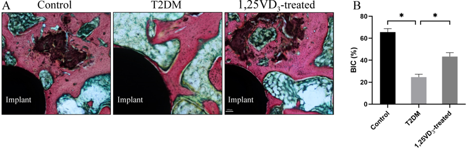 Figure 3: 1,25VD3 promoted bone microarchitecture of T2DM rats. (A) Histological evaluation with methylene blue-acid fuchsin staining (scale bar: 100 μm); (B) Bone-implant contact ratio (BIC, %) , n = 5 specimens/group, *P < 0.05, data are presented as mean ± SD.
