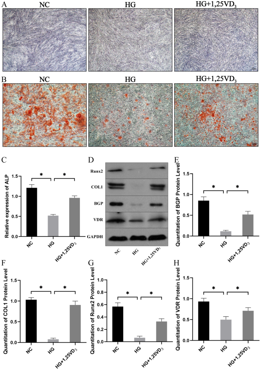 Figure 6: 1,25VD3 restored the OS-mediated damage in osteogenesis. (A)Representative ALP staining images (scale bar: 200 μm); (B) Representative Alizarin Red staining images (scale bar: 1000 μm); (C) Gene expression levels of ALP after 7-day induction; (D, E, F, G and H) Protein expression levels of RUNX2, COL1, BGP and VDR assessed by Western blot and the quantification analysis.