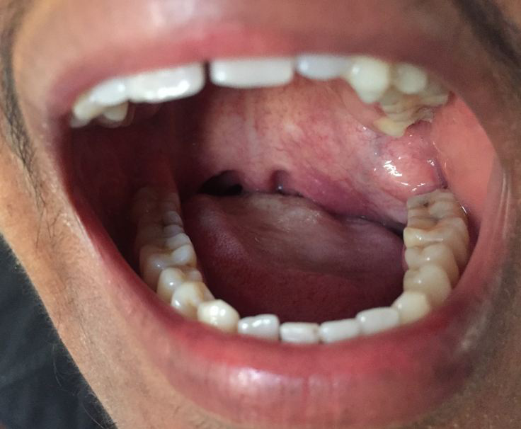 Figure 2: Intra-oral findings.