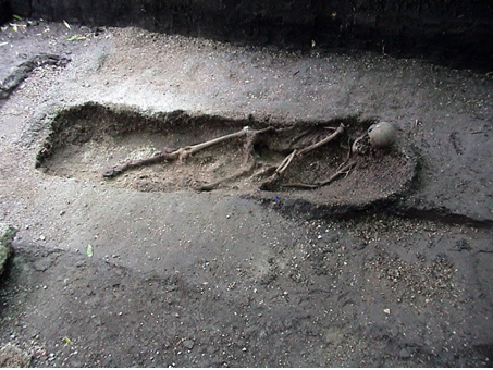 Figure 5: Set of human skeletal remains.