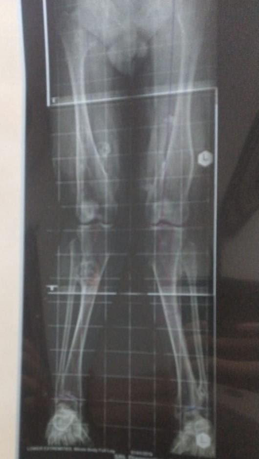 Figure 2: Post-surgical X-ray of patient.