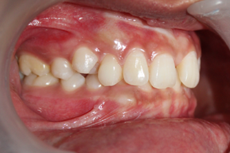 Figure 10: Right Lateral View.