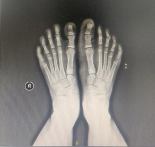 Figure 4: X-ray.