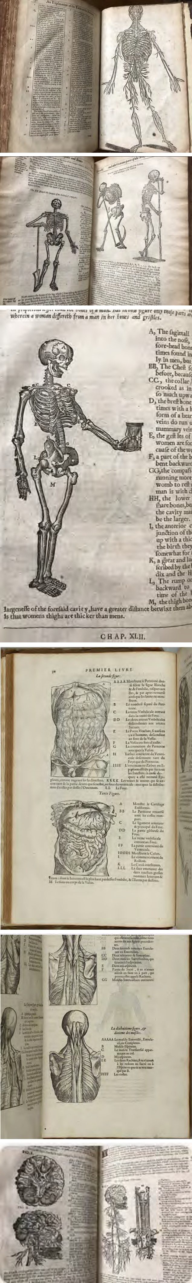 Figure 4: Books on anatomy belonging to Paolo Mascagni.