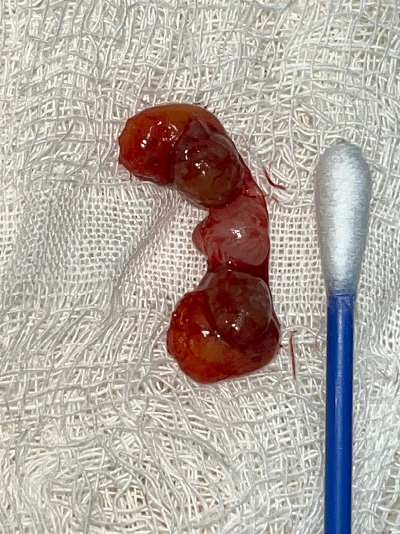 Figure 4: Uterus in light pink and ovaries in dark red.