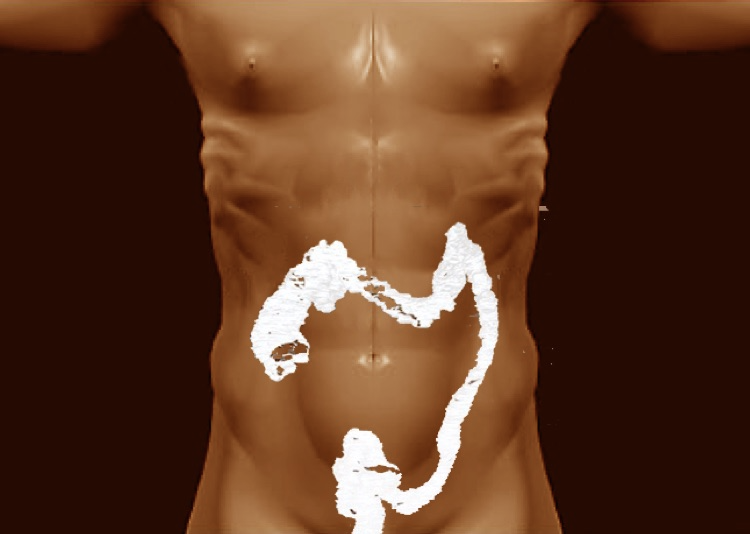 Figure 3: Virtual projection of the hologram on the abdomen using the bone pelvis as an anatomical reference point.
