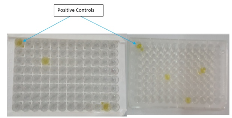 Figure 2: Result of Antigen detection ELISA.