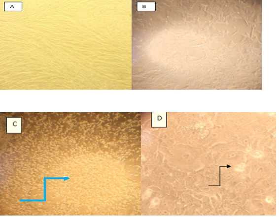 Figure 3: Morphological changes of cells due to Rotavirus infection. (A) Uninfected monolayer of MDBK cells (B) Cell swelling & obscure cell boundaries (C) Cells detachment & floating (D) Cytoplasmic Vacuolation (F) Increased cell granularity (E and G) Cytoplasmic stranding.