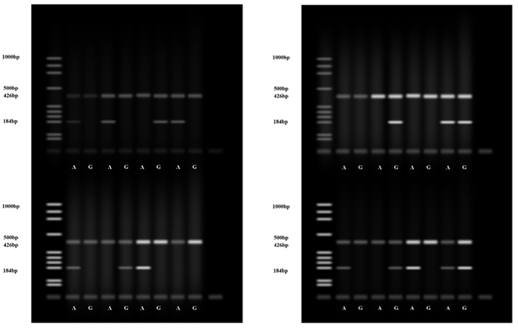 Figure 1: Gel electrophoresis of the anti-refractory mutations system (ARMS) polymerase chain reaction product.