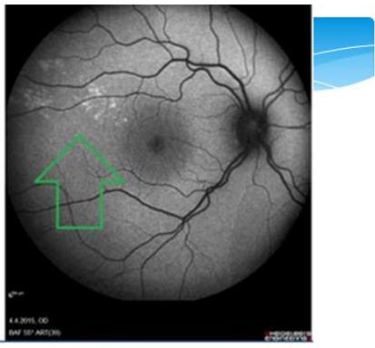Figure 3: Temporal changes on FAF.