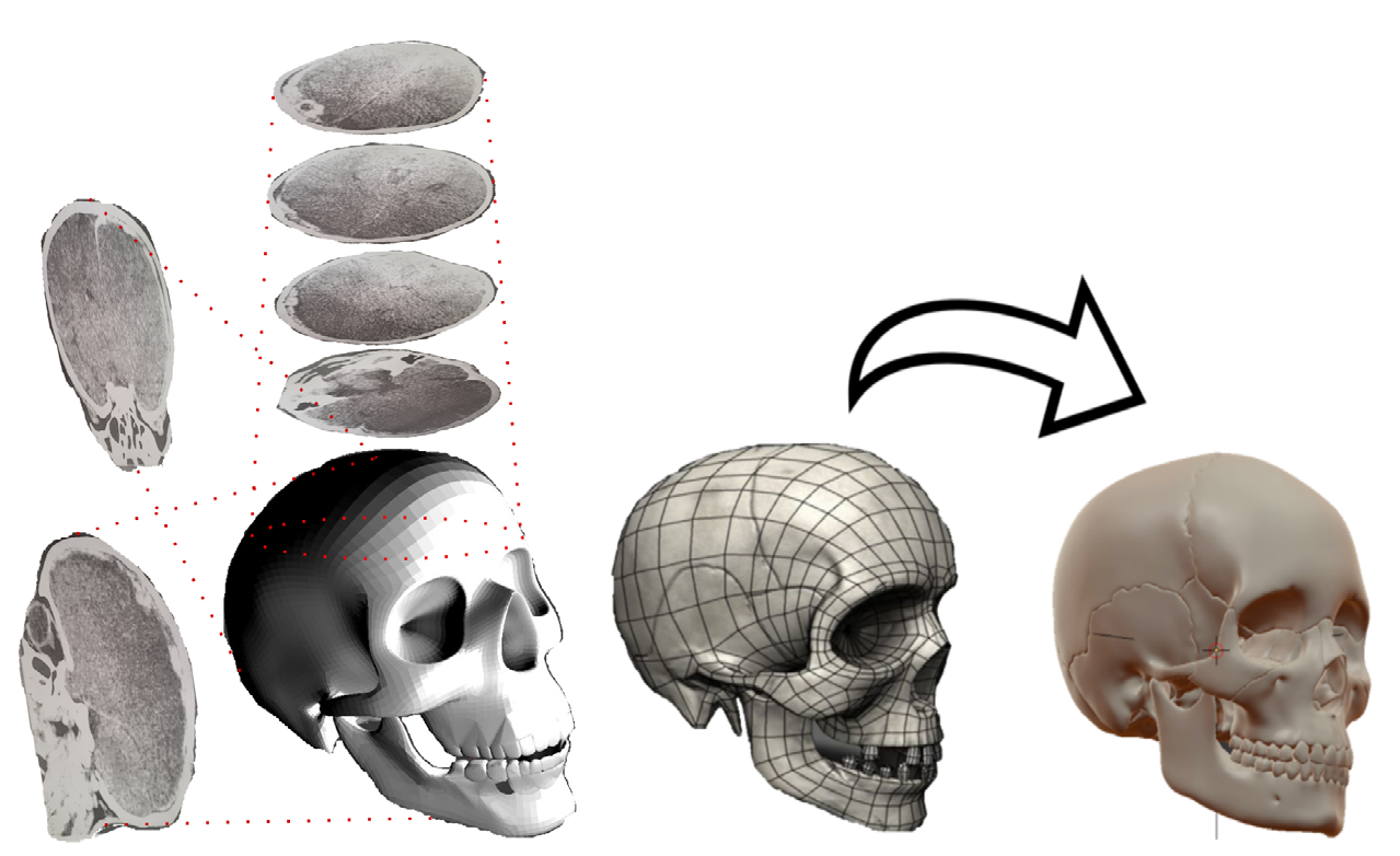 Figure 2: On the Left, Representation of the 3D Modeling of a Skull from Tomographies [7], on the Right, Adaptation of the Meshing of the Skull, as Well as Its Subsequent Smoothing for Presentation Purposes Before the Judge [8].