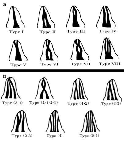 Figure 1: Schematic diagram showing the root canal configuration according to (a) Vertucci and (b) Gulabivala.