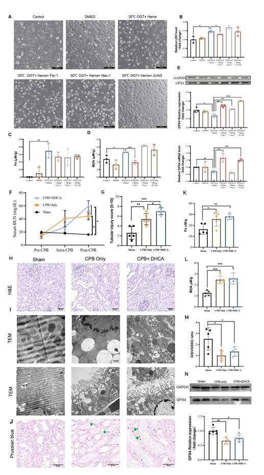 Figure 1: (A) Cellular morphology under a phase contrast microscope. Levels of (B) medium LDH content, (C) intracellular iron and (D) MDA in HK-2 cells of different groups showed that Fer-1 treatment down-regulated the LDH and MDA content, whereas iron levels were not reduced. (E) The protein and mRNA levels of GPX4 in HK-2 cells of different groups showed that Fer-1 treatment greatly increased the expression of GPX4 expression. (F) BUN of rats during surgery and (G) HE staining showed that renal injury was induced by CPB/DHCA; scale bar: 50 μm. (H) The renal tubular injury score was calculated. (I) Representative images of transmission electron microscope for mitochondria in rat kidney showed mitochondria distortedness and shrink was induced by CPB/DHCA; scale bar: 50 μm. (J) Prussian blue staining for iron showed that on-pump cardiac surgery increased the level of ferric iron; the green arrows indicate deposition of iron; scale bar: 50 μm. (K-M) Levels of iron, MDA and GSH/GSSG in the kidney tissues showed that iron and MDA were significantly upregulated, whereas GSH/GSSG was down-regulated in CPB/DHCA groups compared with sham group. (N) Representative results of Western blotting showed that the protein levels of GPX4 were significantly decreased in the kidneys of CPB/DHCA rats; the images are quantified using Image J.