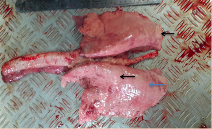 Figure 2: Lung suspected of adenocarcinoma blue arrow. The lung is edematous, collapsed, and the effect of the ribs can be seen on the dorsal surface, black arrow. Light gray foci with a diameter of several millimeters to several centimeters can be seen.