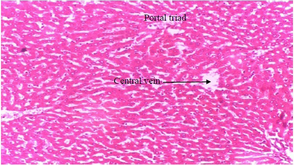 Figure 5: Photomicrograph of liver section of rat administered ethanolic extract of riped fruit of Dennettia tripetala (400mg/ kg) (Group 3).