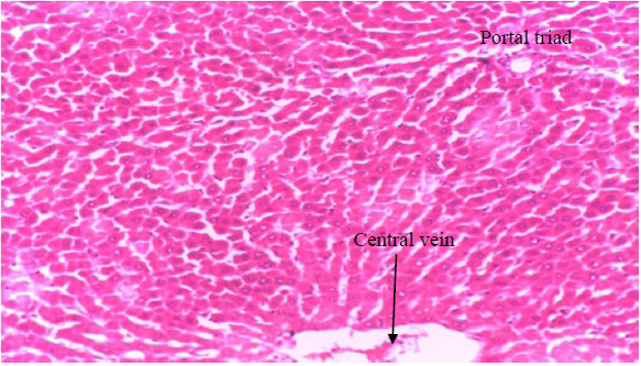 Figure 7: Photomicrograph of liver section of rat administered ethanolic extract of unriped fruit of Dennettia tripetala (400mg/ kg) (group 5)
