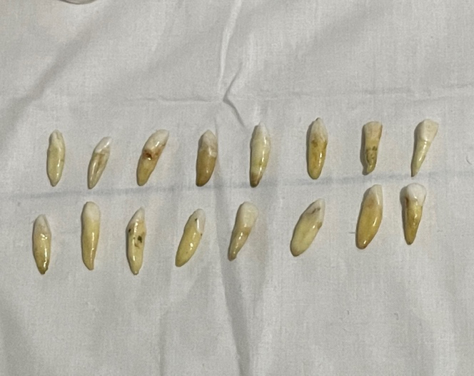 Figure 2: Single-rooted teeth.