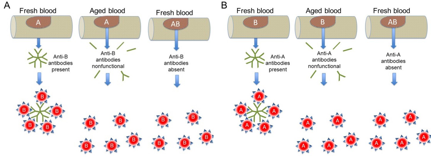 Figure 2: Mixed Agglutinin Method for Forward Typing of Fresh Vs Aged Samples. In (A), fresh and aged blood samples that are type A are evaluated using the Lattes method. A visible reaction is not observed with aged blood as antibodies have become nonfunctional over time (compare left and middle); note that this result is the same as a person having AB blood (right). (B) Similar to (A), except that an example is shown using red blood cells of the B type. Note that antigens, antibodies, and red blood cells are not drawn to scale in this figure.