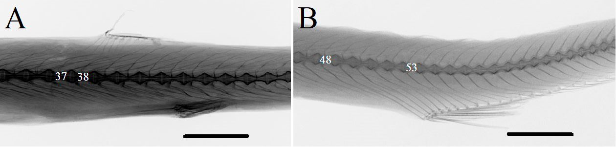 Figure 1: Roentgenogram Arctozenus australis ZIN 56771-1, A – dorsal and ventral fins area, B – anal fin. Scale bar 10 mm.