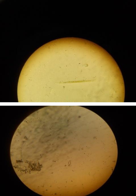 Figure 6: Bacterial growth on nutrient agar for cultures taken from tile surfaces of TiO2- treated (a) and untreated (b) glazed tiles. Identification of fungi on ceramic tiles according to the usual morphological criteria under light microscope both of ceramic tiles with TiO2 and without TiO2 not contain fungi is shown in Table 4.