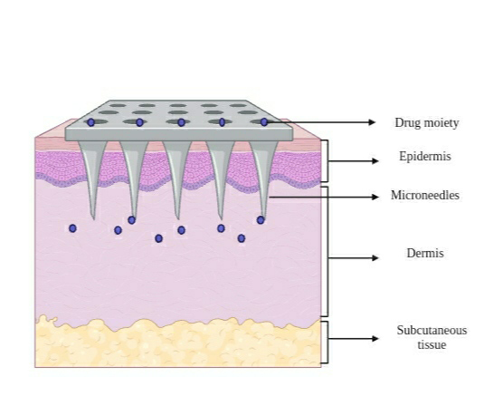 Figure 3: Injected Microneedle.