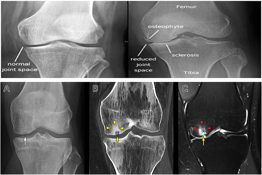 Figure 1: soft tissues, cartilage, and subchondral bone, aiding in the assessment of disease severity and progression.