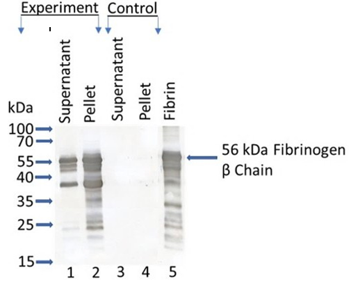 Figure 1: Protease Activity of FGL2. Western blot analyses were performed to examine the conversion of soluble fibrinogen to insoluble fibrin polymers by thrombin produced by homogeneous fraction of FGL2 from prothrombin. The homogeneous fraction of FGL2 was purified following the procedure of Nagdas, et al. [63]. Fibrinogen, prothrombin, and fibrin were purchased from Sigma-Aldrich Chemical Company. First, the conversion of prothrombin to thrombin by purified FGL2 was performed. Then, fibrinogen (0.2mg) was added to the reaction mixture after converting prothrombin to thrombin by FGL2. As a control, parallel reaction was performed without the addition of fibrinogen where no precipitation was found. Both supernatant and pellet fractions of experiment and control were analyzed by Western Blot analysis stained with rabbit monoclonal antibody to fibrinogen β chain. Immunoreactive bands were visualized by color development with diaminobenzidine and H2O2. Note that the 56kDa fibrinogen β was present in the pellet (lane 2) of experiment, demonstrating the conversion of soluble fibrinogen to insoluble fibrin polymers. Other immunoreactive bands in the pellet of experiment (lane 2) could be different fibrin polymers having different molecular weights. Lane 1 represents the supernatant fraction of experiment showing the remaining soluble fibrinogen. Lanes 3 and 4 represent the supernatant and the pellet fractions of control. Lane 5 represents the fibrin (2µg) as a positive control. The results are representative of three experiments.