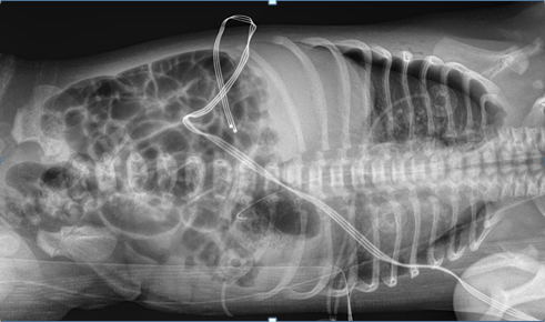Figure 2: The findings were confirmed on lateral view.