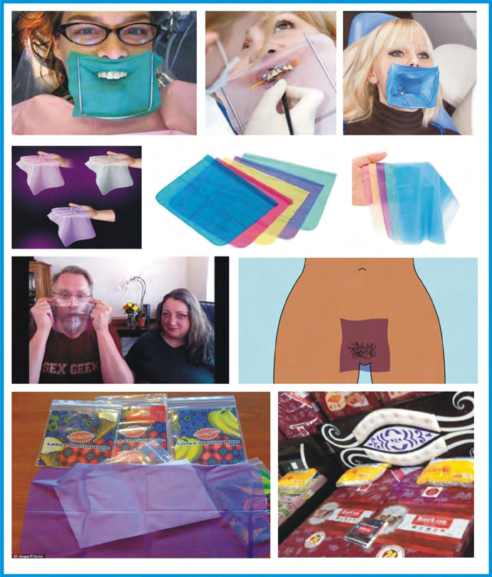 Figure 10: Dentist’s dental dams and dental dams for oral sex performance, placed side-by-side [29,39 -41].