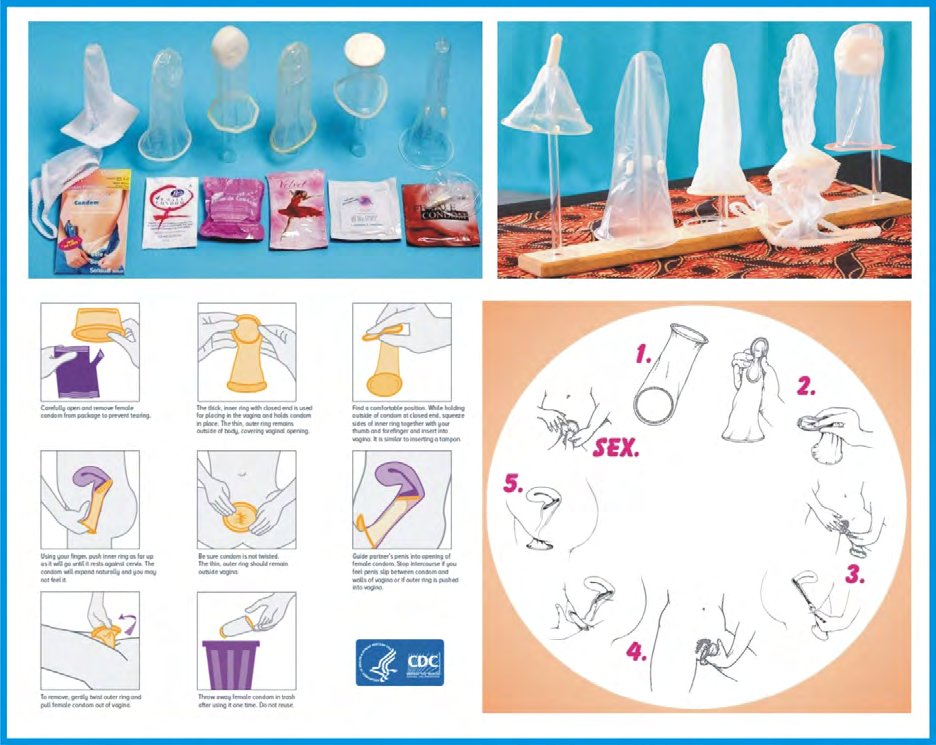 Figure 7: How to Insert and Remove a Female (Internal) Condom [26].
