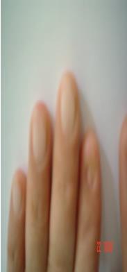 Figure 6: Horns.
