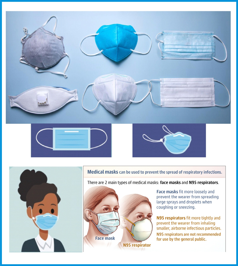 Figure 24: Typical example of the present day surgical masks and surgical N95 respirators [74-77]. Existing Configuration of Face Barrier Coverings: In the day to day language “Face Barrier Coverings” i.e. the devices that are worn on the face, which covers at least the nose and mouth, with the primary purpose of providing source control  and to provide a degree of particulate filtration to reduce the amount of inhaled particulate material are collectively referred to as mask or face mask. In reality, they are simply distinguished as particulate respirators and particulate face masks or technically distinguished as surgical respirators; non- surgical respirators, medical/ surgical face mask, and non- surgical/medical face mask (i.e. cloth/homemade face mask). They differ by their configuration type and effectiveness of filtering infectious particles and wedging droplets via inhalation and exhalation. In all, the basic, “regulatory standards require that the face barrier covering should not permit blood or other potentially infectious materials to pass through to or reach the wearer’s skin, eyes, nose, mouth, or other mucous membranes under normal conditions of use and for the duration of time that the protective equipment will be used.” Furthermore, particulate respirators are distinguished as either valve- respirators or non valve- respirators. The valve- respirators make it easier to exhale air which makes them more comfortable to wear, because it leads to less moisture build-up inside the respirator. However, “the problem with valve respirators is that they “do not” filter the wearer’s exhalation, only the inhale. This one-way protection puts others around the wearer at risk.