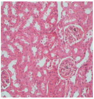 Figure 4: 1**.**