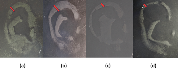 Figure 3: Helix Forms (A) Normally Rolled (B) Wide Covering Scapha (C) Concave Margina (D) Flat.